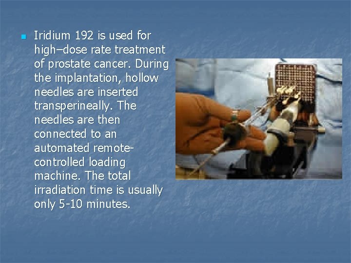 n Iridium 192 is used for high–dose rate treatment of prostate cancer. During the