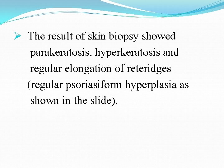 Ø The result of skin biopsy showed parakeratosis, hyperkeratosis and regular elongation of reteridges