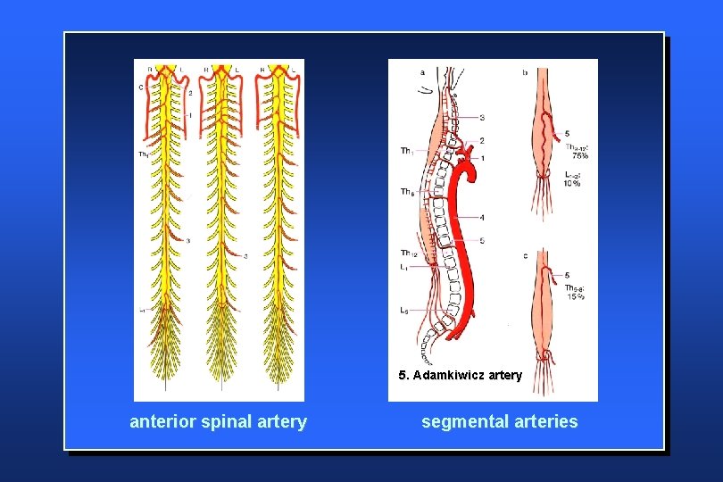 5. Adamkiwicz artery anterior spinal artery segmental arteries 