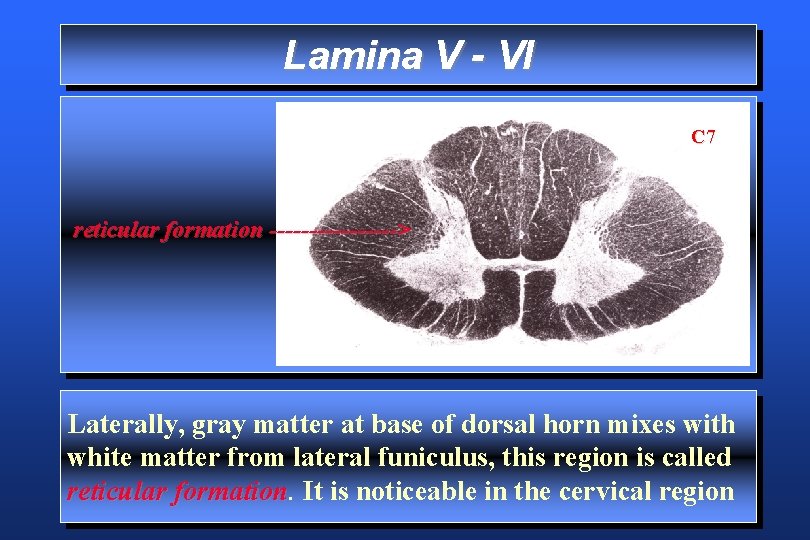 Lamina V - VI C 7 reticular formation --------> Laterally, gray matter at base