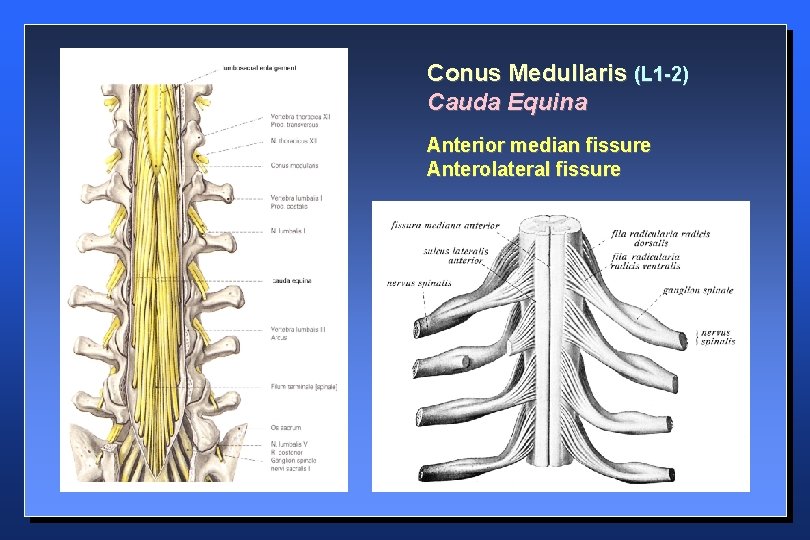 Conus Medullaris (L 1 -2) Cauda Equina Anterior median fissure Anterolateral fissure 