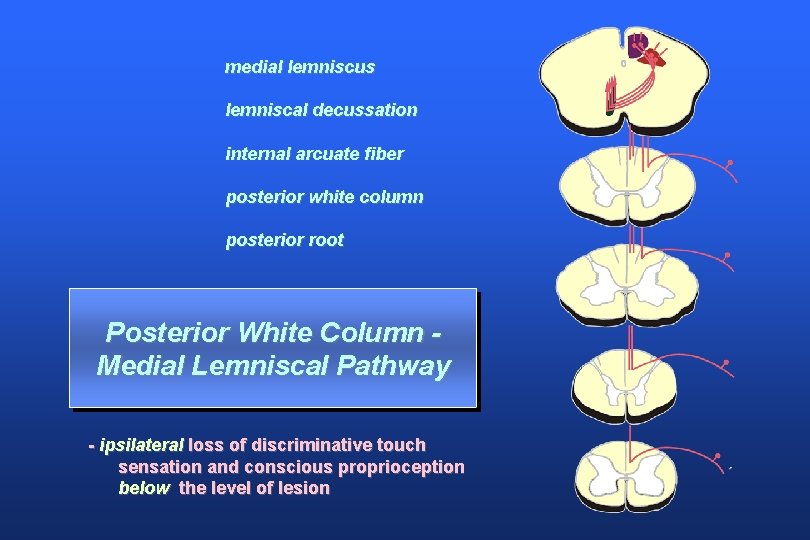 medial lemniscus lemniscal decussation internal arcuate fiber posterior white column posterior root Posterior White