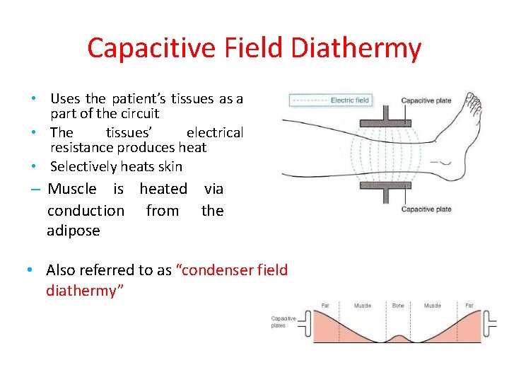 Capacitive Field Diathermy • Uses the patient’s tissues as a part of the circuit