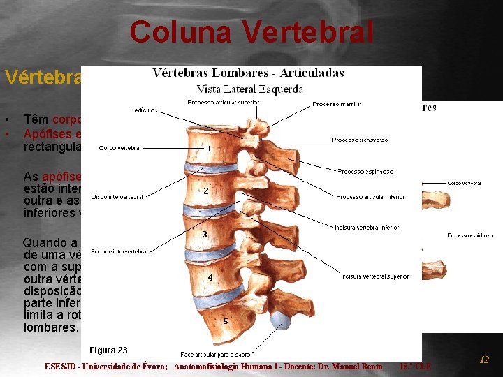 Coluna Vertebral Vértebras Lombares (L): • • Têm corpos largos e espessos; Apófises espinhosas