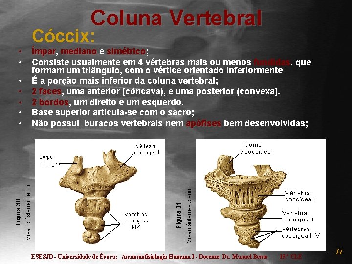 Coluna Vertebral Cóccix: • • Visão ântero-superior Visão póstero-inferior Figura 30 • • •