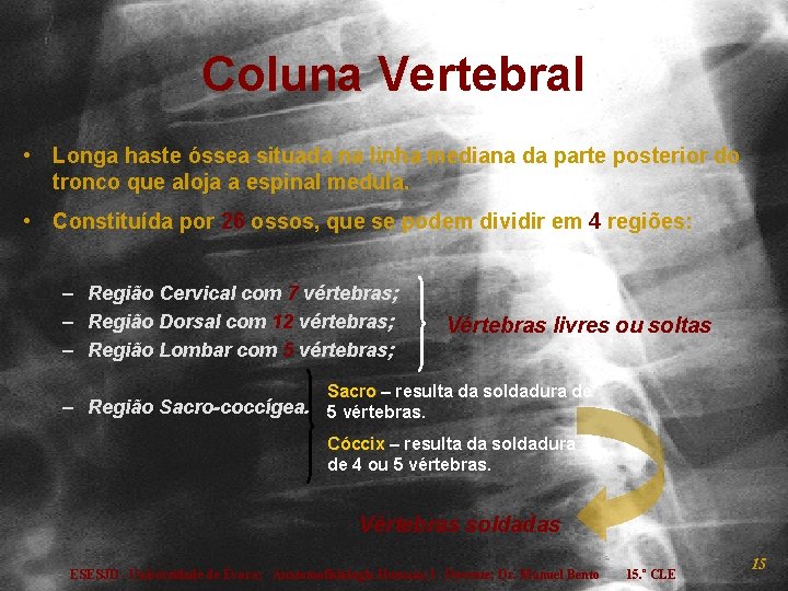 Coluna Vertebral • Longa haste óssea situada na linha mediana da parte posterior do