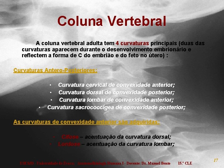 Coluna Vertebral A coluna vertebral adulta tem 4 curvaturas principais (duas das curvaturas aparecem