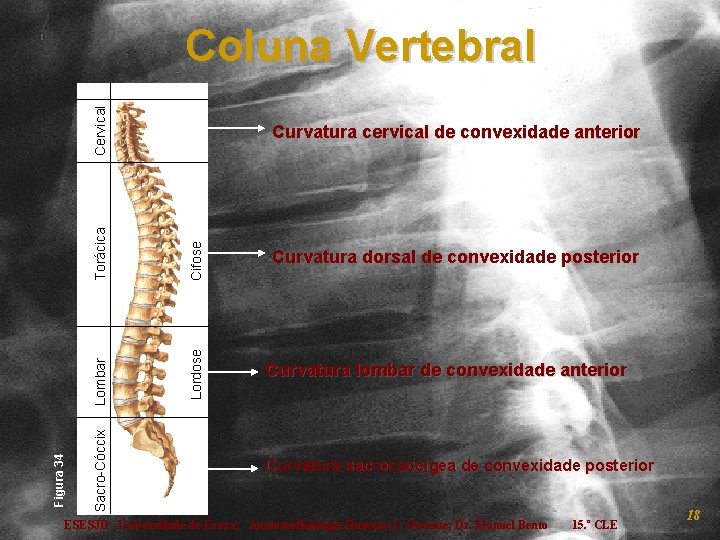 Torácica Cifose Lordose Curvatura cervical de convexidade anterior Lombar Sacro-Cóccix Figura 34 Cervical Coluna