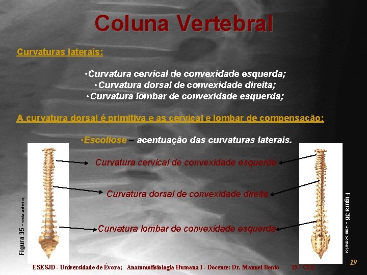 Coluna Vertebral Curvaturas laterais: • Curvatura cervical de convexidade esquerda; • Curvatura dorsal de