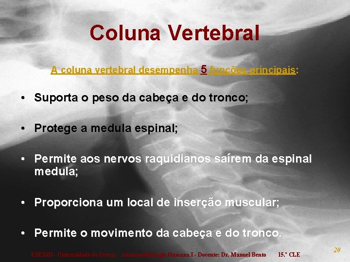 Coluna Vertebral A coluna vertebral desempenha 5 funções principais: • Suporta o peso da