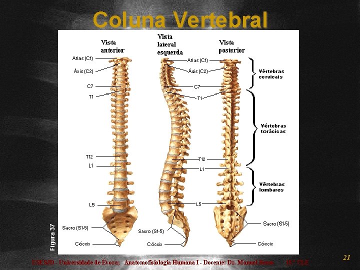 Figura 37 Coluna Vertebral ESESJD - Universidade de Évora; Anatomofisiologia Humana I - Docente: