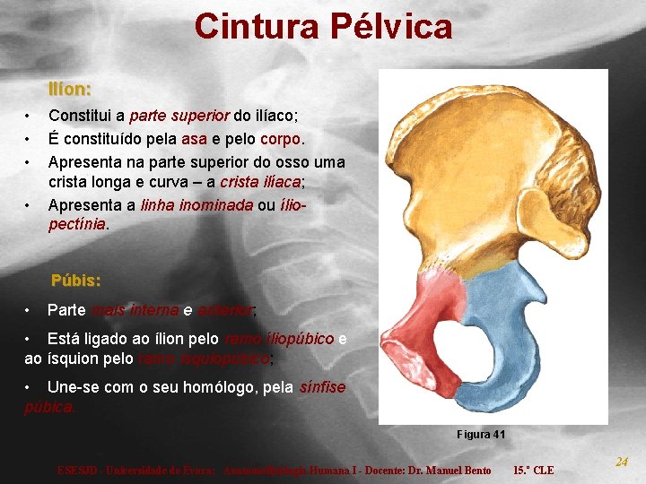 Cintura Pélvica Ilíon: • • Constitui a parte superior do ilíaco; É constituído pela