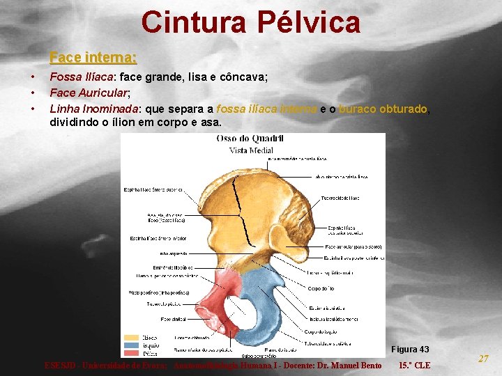 Cintura Pélvica Face interna: • • • Fossa Ilíaca: face grande, lisa e côncava;