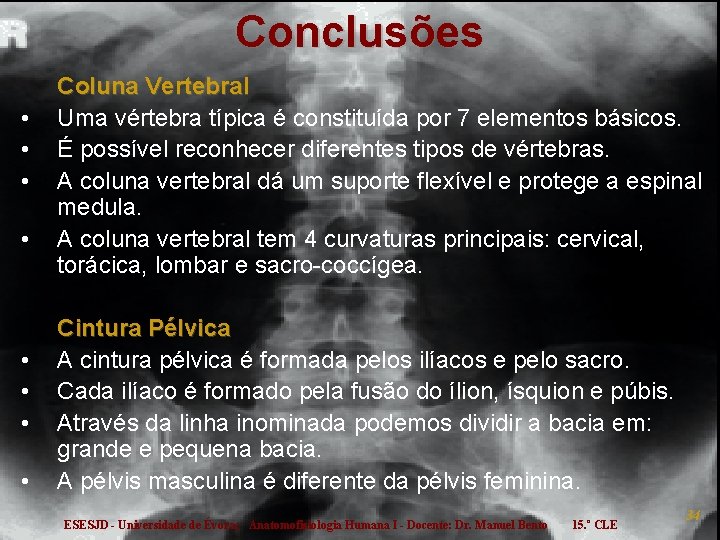 Conclusões • • Coluna Vertebral Uma vértebra típica é constituída por 7 elementos básicos.