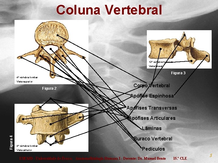 Coluna Vertebral 12ª vértebra torácica Vista lateral Figura 3 4ª vértebra lombar Vista superior