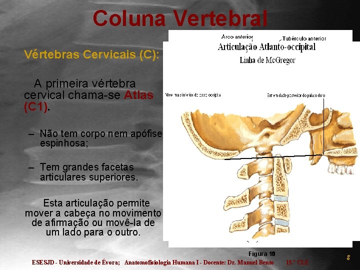 Coluna Vertebral Vértebras Cervicais (C): A primeira vértebra cervical chama-se Atlas (C 1). –