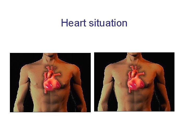 Heart situation 