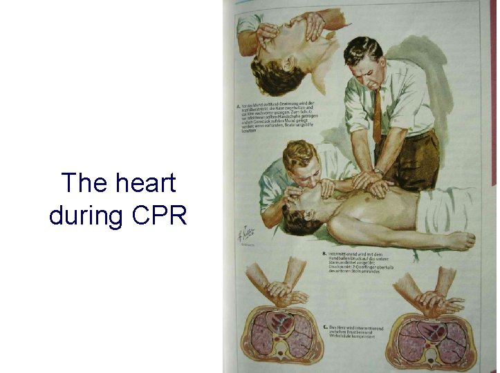 The heart during CPR 