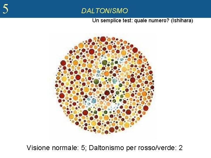 5 DALTONISMO Un semplice test: quale numero? (Ishihara) Visione normale: 5; Daltonismo per rosso/verde: