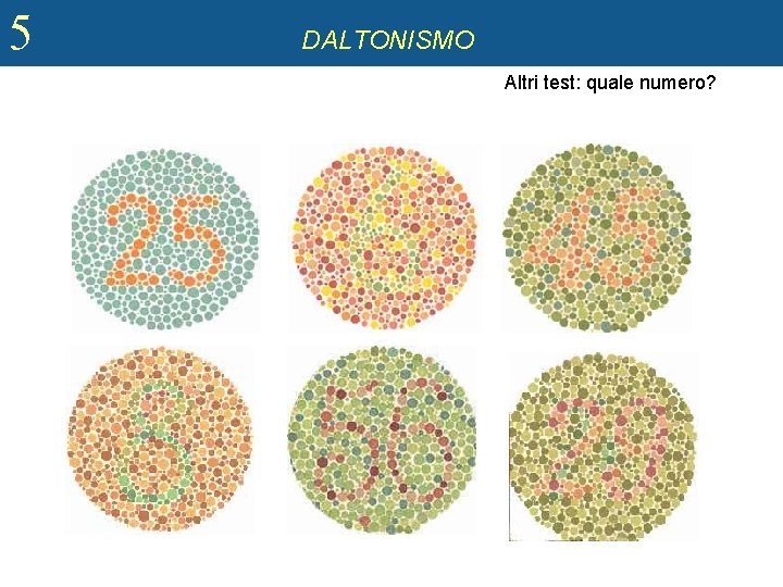 5 DALTONISMO Altri test: quale numero? 