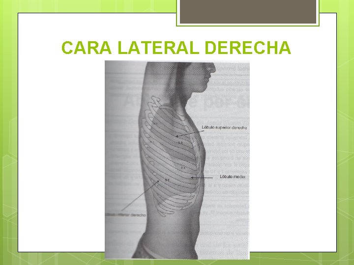 CARA LATERAL DERECHA 