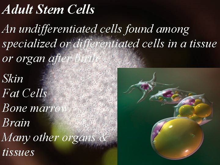 Adult Stem Cells An undifferentiated cells found among specialized or differentiated cells in a