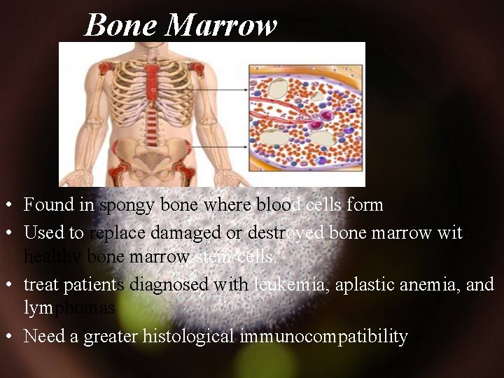 Bone Marrow • Found in spongy bone where blood cells form • Used to