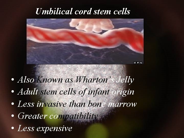 Umbilical cord stem cells • • • Also Known as Wharton’s Jelly Adult stem