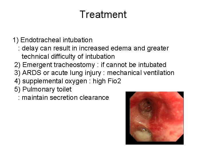 Treatment 1) Endotracheal intubation : delay can result in increased edema and greater technical