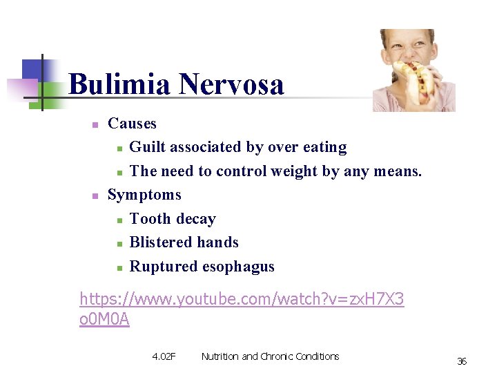 Bulimia Nervosa n n Causes n Guilt associated by over eating n The need Bulimia Nervosa n n Causes n Guilt associated by over eating n The need