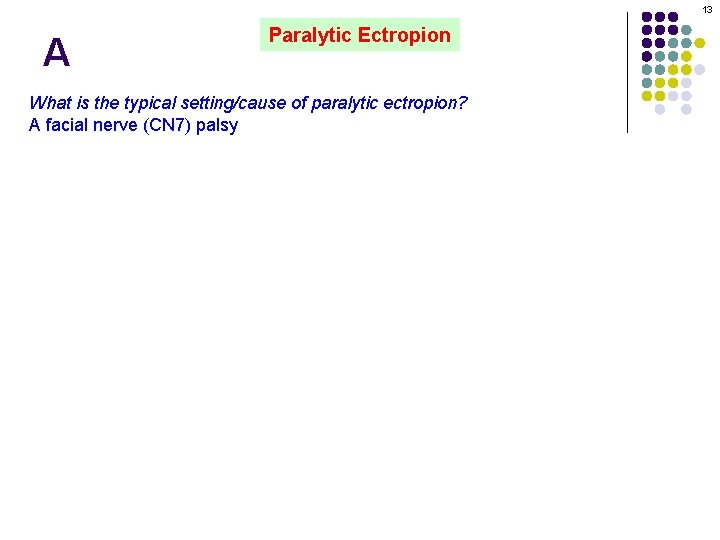 13 A Paralytic Ectropion What is the typical setting/cause of paralytic ectropion? A facial