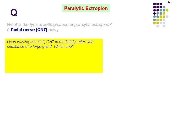 14 Q Paralytic Ectropion What is the typical setting/cause of paralytic ectropion? A facial