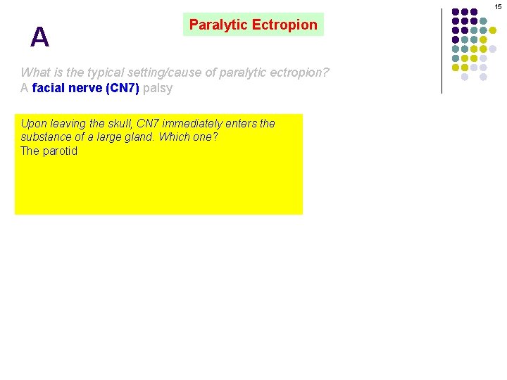 15 A Paralytic Ectropion What is the typical setting/cause of paralytic ectropion? A facial