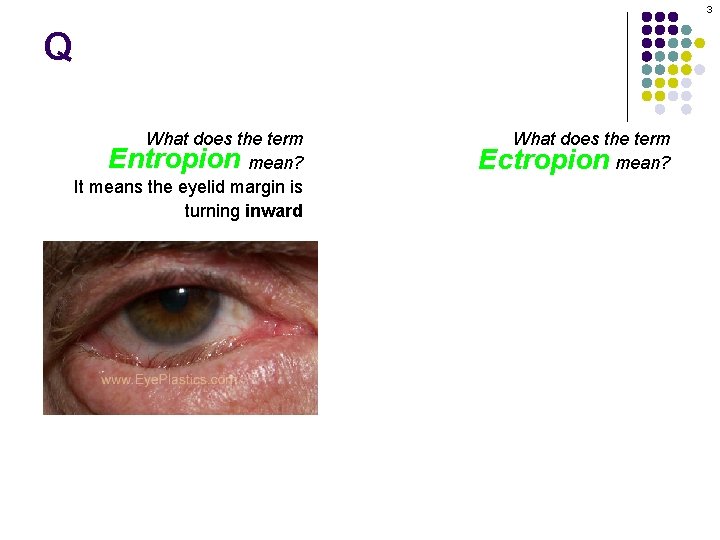 3 Q What does the term Entropion mean? It means the eyelid margin is