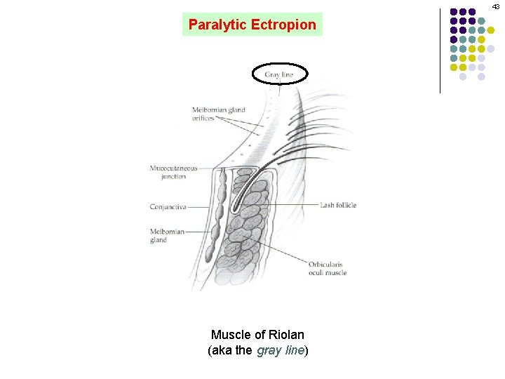 43 Paralytic Ectropion Muscle of Riolan (aka the gray line) 