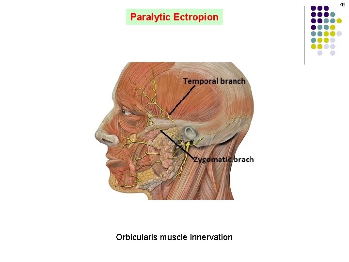 46 Paralytic Ectropion Orbicularis muscle innervation 