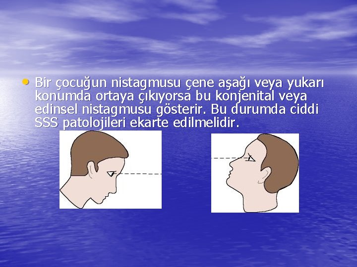  • Bir çocuğun nistagmusu çene aşağı veya yukarı konumda ortaya çıkıyorsa bu konjenital