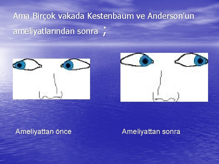 Ama Birçok vakada Kestenbaum ve Anderson’un ameliyatlarından sonra Ameliyattan önce ; Ameliyattan sonra 