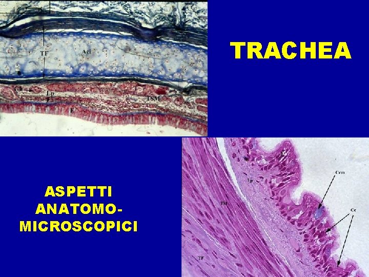 TRACHEA ASPETTI ANATOMOMICROSCOPICI 