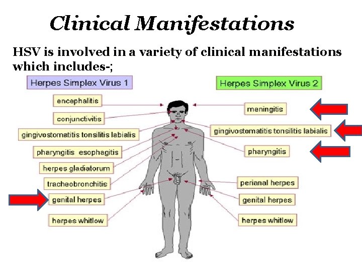 Clinical Manifestations HSV is involved in a variety of clinical manifestations which includes-; 