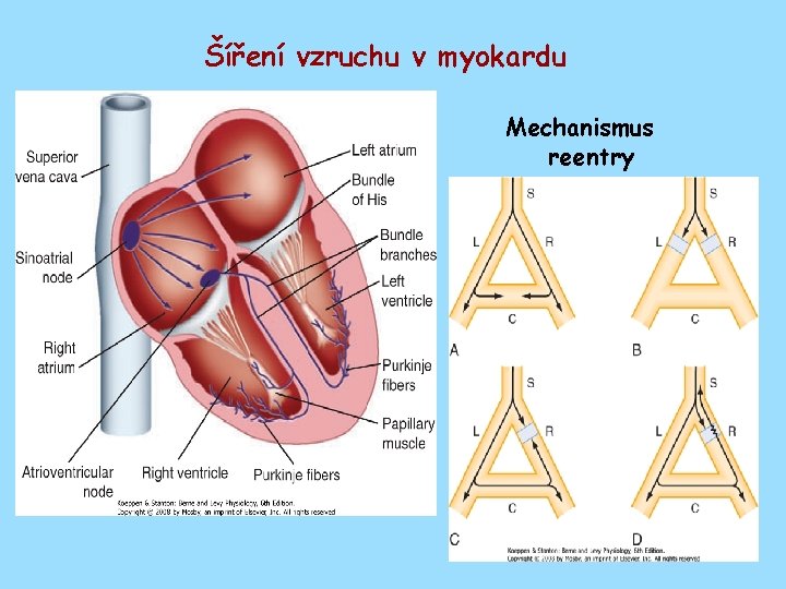 Šíření vzruchu v myokardu Mechanismus reentry 