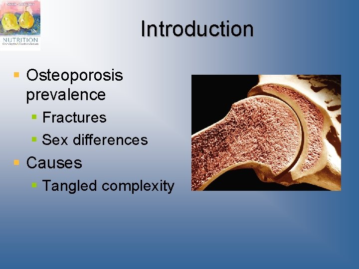 Introduction § Osteoporosis prevalence § Fractures § Sex differences § Causes § Tangled complexity