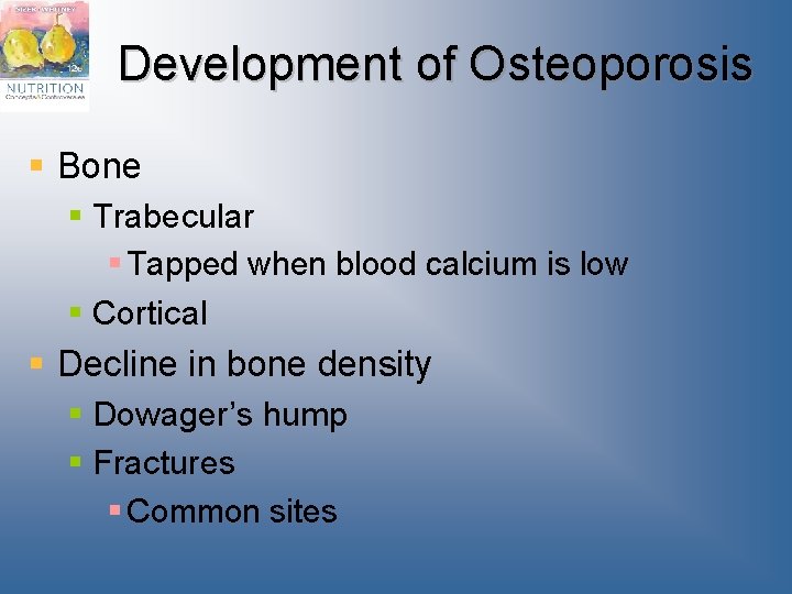 Development of Osteoporosis § Bone § Trabecular § Tapped when blood calcium is low