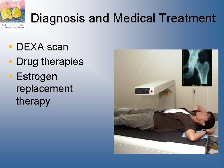 Diagnosis and Medical Treatment § DEXA scan § Drug therapies § Estrogen replacement therapy