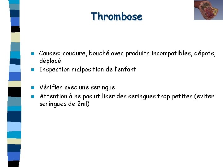 Thrombose Causes: coudure, bouché avec produits incompatibles, dépots, déplacé n Inspection malposition de l’enfant