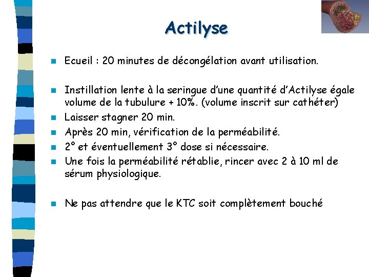 Actilyse n Ecueil : 20 minutes de décongélation avant utilisation. n Instillation lente à