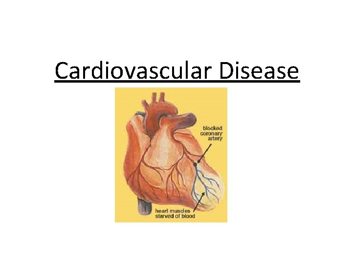 Cardiovascular Disease 