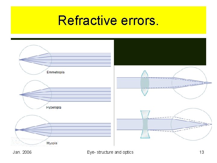 Refractive errors. Jan. 2006 Eye- structure and optics 13 Refractive errors. Jan. 2006 Eye- structure and optics 13