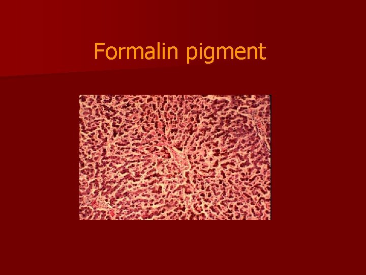 Formalin pigment 