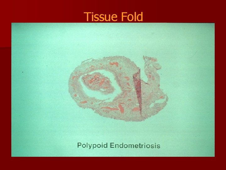 Tissue Fold 